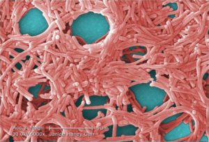 2009 Margaret Williams, PhD; Claressa Lucas, PhD;Tatiana Travis, BS Under a moderately-high magnification of 5000X, this colorized scanning electron micrograph (SEM) depicted a large grouping of Gram-negative Legionella pneumophila bacteria. Please see PHIL 11092 through 11154 for additional SEMs of these organisms, specifically PHIL 11147 for a black and white version of this image. Of particular importance, is the presence of polar flagella, and pili, or long streamers, which due to their fragile nature, in some of these views seem to be dissociated from any of the bacteria. Youll note that a number of these bacteria seem to display an elongated-rod morphology. L. pneumophila are known to most frequently exhibit this configuration when grown in broth, however, they can also elongate when plate-grown cells age, as it was in this case, especially when theyve been refrigerated. The usual L. pneumophila morphology consists of stout, fat bacilli, which is the case for the vast majority of the organisms depicted here. These bacteria originated on a 1 week-old culture plate (+/- 1 day), which had incubated a single colony, at 37?C upon a buffered charcoal yeast extract (BCYE) medium with no antibiotics.
